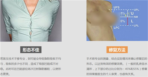 韩国原辰胸部修复方法