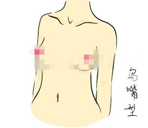小测试：6种常见胸型 你的胸是否标准！