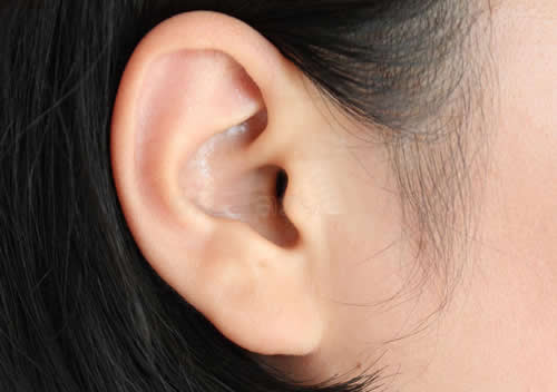韩国普罗菲耳耳朵整形
