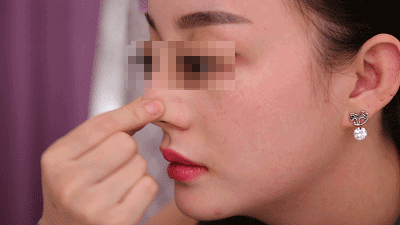韩国隆鼻整形排名前五医院揭秘，差评超低你值得一看！