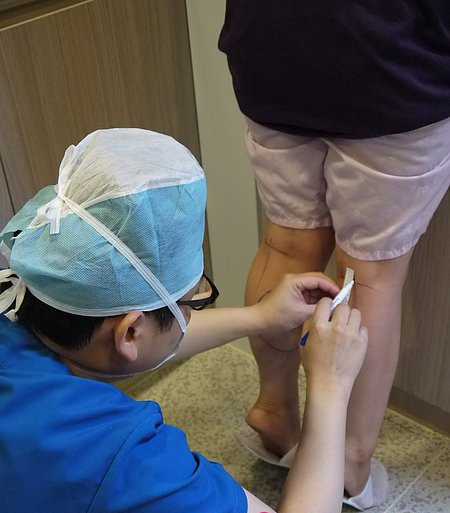 韩国医院小腿整形优势有哪些？