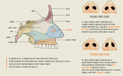 韩国Noble＆Cosmo整形外科隆鼻介绍图