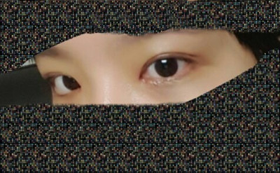 韩国本爱整形医院双眼皮案例