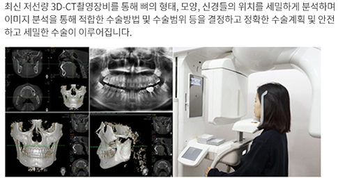 韩国下颌角手术价格PK，本爱和英格谁性价比高？