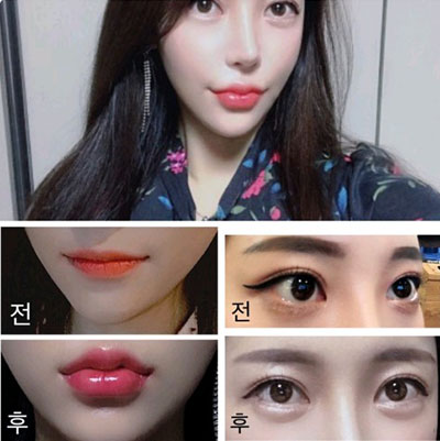 韩国dress整形外科眼唇整形案例