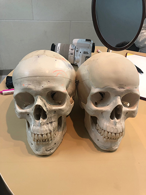 韩国雕刻整形外科头骨整形模型