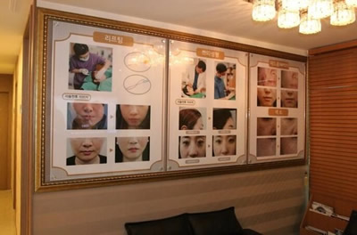 韩国CU可琳雅医院日记展示