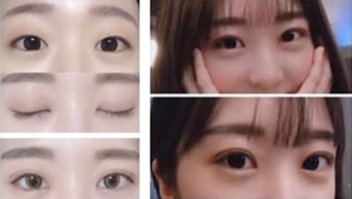 网评韩国crapas的双眼皮比别家好看还自然，事实是这样吗？