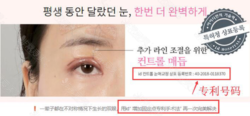 韩国ID整形外科大小眼整形方法图示