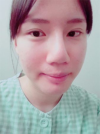 韩国kowon整形外科鼻综合