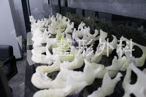 韩国H整形3D打印骨骼模型照片