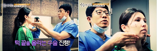 韩国SF整形外科面部轮廓手术有什么不一样？案例对比如何？