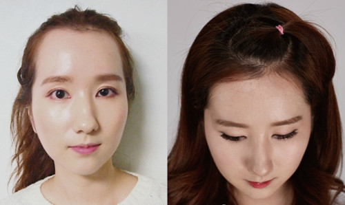 韩国forhair中心算是专业的毛发移植医院吗？都有哪些优势？
