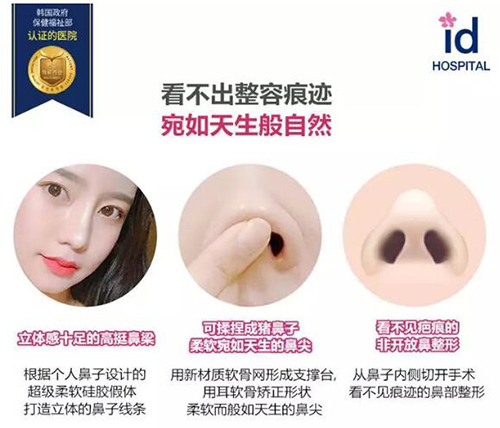 韩国ID整形外科隆鼻优势图