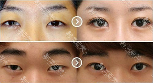 金宪俊在韩国任职哪家医院？做眼部手术非常靠谱是真假？
