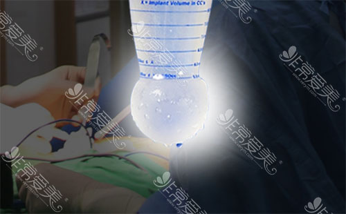 韩国假体隆胸手术细节图片