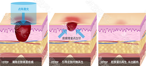 韩国皮肤管理好医院收录（三）：TAM皮肤科VS韩国CU可琳雅