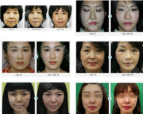 韩国皮肤管理好医院收录（四）：蕾切尔VS美来可