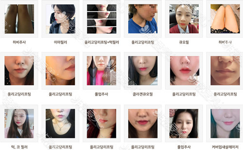韩国raffine整形外科位置在哪？擅长皮肤护理和面部填充吗？