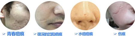 面部皮肤主要存在的问题