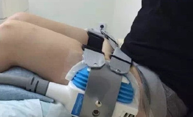 韩国童颜医院冷冻脂肪手术实拍图