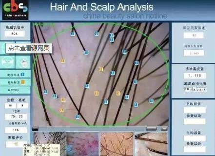 韩国久长医院检测毛囊设备展示