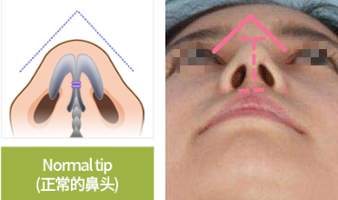 正常鼻子的内部构造图