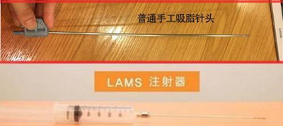 韩国365MC医院的lans吸脂针头实拍图
