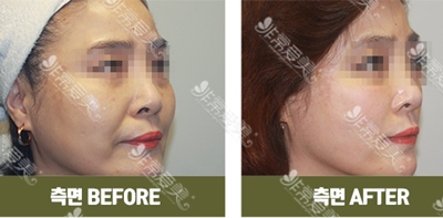 韩国TATOA皮肤管理效果展示