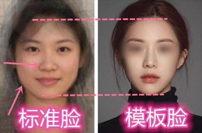 你与韩国整形模板差了点啥?（上）：颅顶、鼻子与轮廓手术