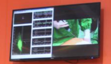 韩国365MC医院吸脂使用AI技术可靠