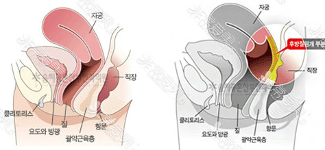 韩国首尔妇科医院排名：紧缩子宫复位 这几家方式略有差异