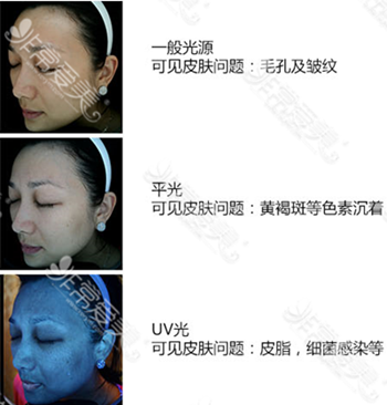 韩国LAMICHE皮肤美容术法展示图