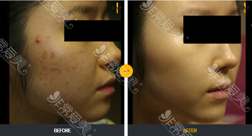 韩国cnp皮肤科医院分享，除化妆品他们家皮肤管理也有优势