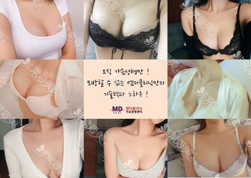 韩国MD医院胸部整形官网图
