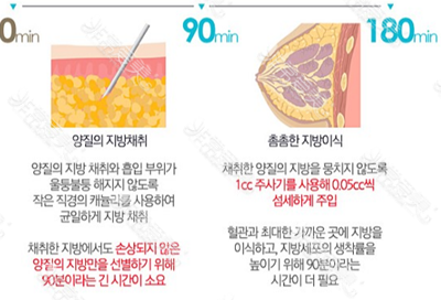 韩国star21整形外科脂肪隆胸术法详解