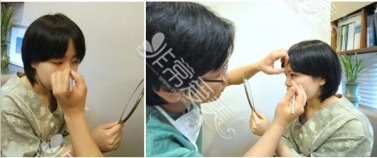 韩国IWANT整形外科朴炳柱院长面诊实拍图