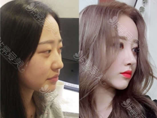 韩国混血隆鼻风格照片