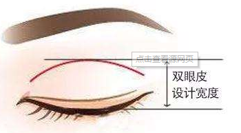 韩国POP整形外科医院双眼皮修复怎么样