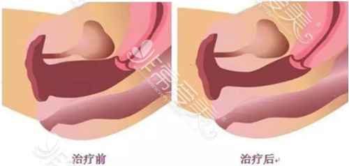 韩国好手艺私密整形医院在哪里?地址+特色项目通通告诉你！