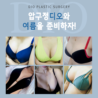 韩国DIO整形外科胸部手术合集