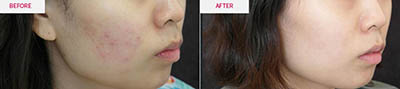 韩国美思科整形医院皮肤护理照片