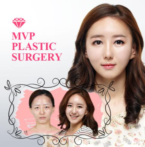 韩国mvp整形外科眼部手术对比日记