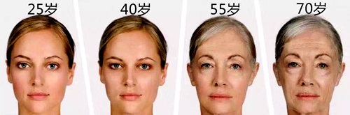 女性一生不同年龄阶段面部衰老示意图