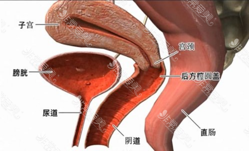 后方膣圆盖术靠谱吗？为什么别的韩国妇科医院医生不能做?