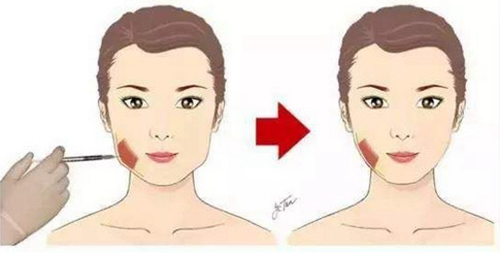 面部吸脂or瘦脸针如何选择?韩国明星线和迪美丽医院告诉你!