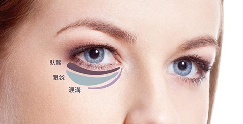 韩国宝士丽整形医院眼底脂肪重组能有效的改善眼袋、黑眼圈