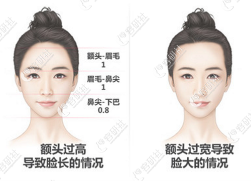 有没有能把长脸变短的手术？韩国改脸型口碑医院有哪些？