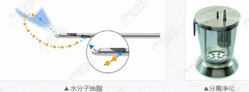 韩国原辰整形外科医院Harvest-jet分离细胞方式