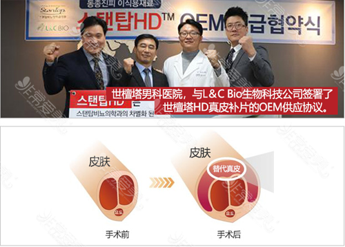 韩国世檀塔医院增大增粗示意图